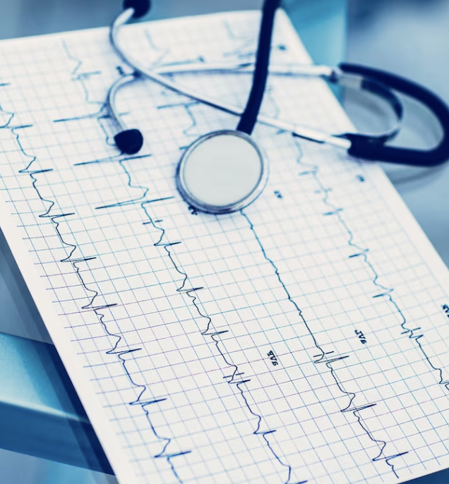 Tracé ECG et stéthoscope illustrant l’évaluation diagnostique d’une bradycardie