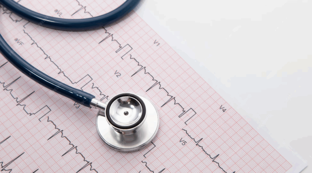 Gros plan sur un ECG montrant un rythme lent, pouvant évoquer un bloc auriculo-ventriculaire