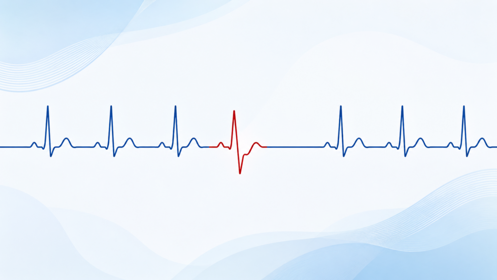 Tracé ECG montrant une extrasystole ventriculaire au milieu d'un rythme normal