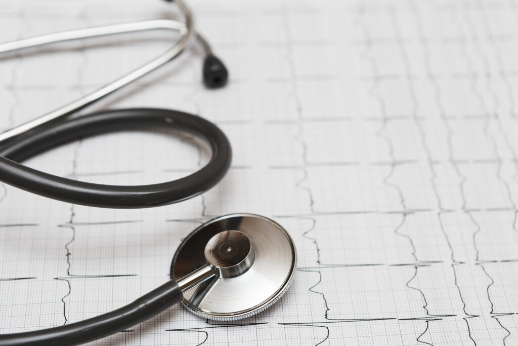 comparaison ECG QT normal et QT long montrant un allongement de la repolarisation ventriculaire