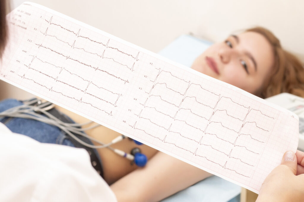 cardiologist analyse heartbeat rythm